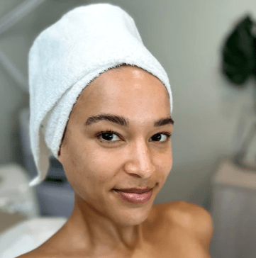 Facelift Without Needles