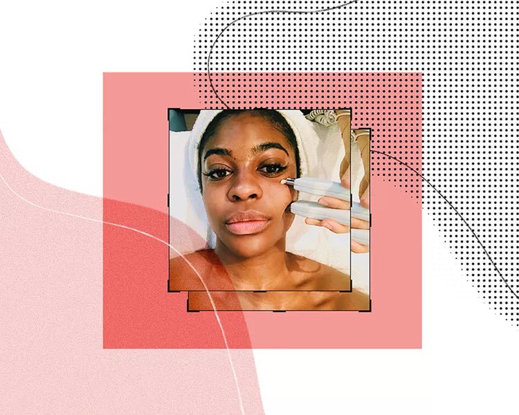 Microcurrent Will Sculpt Your Complexion - Joanna Vargas