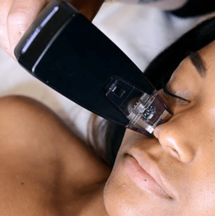 Morpheus8 at Joanna Vargas