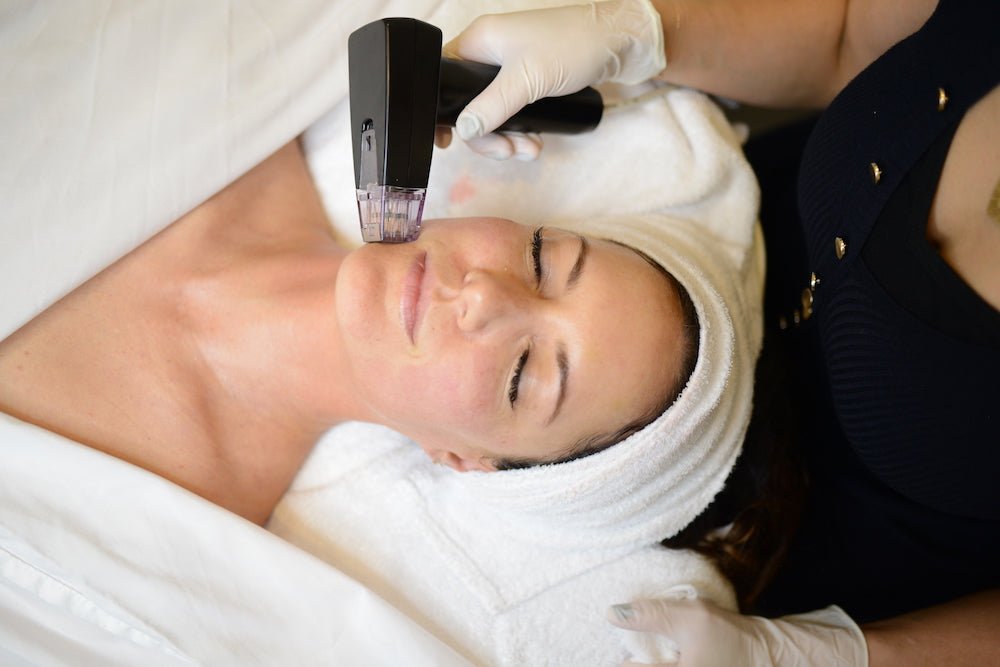 The Celebrity-Approved Beauty Secret: Morpheus8 - Joanna Vargas
