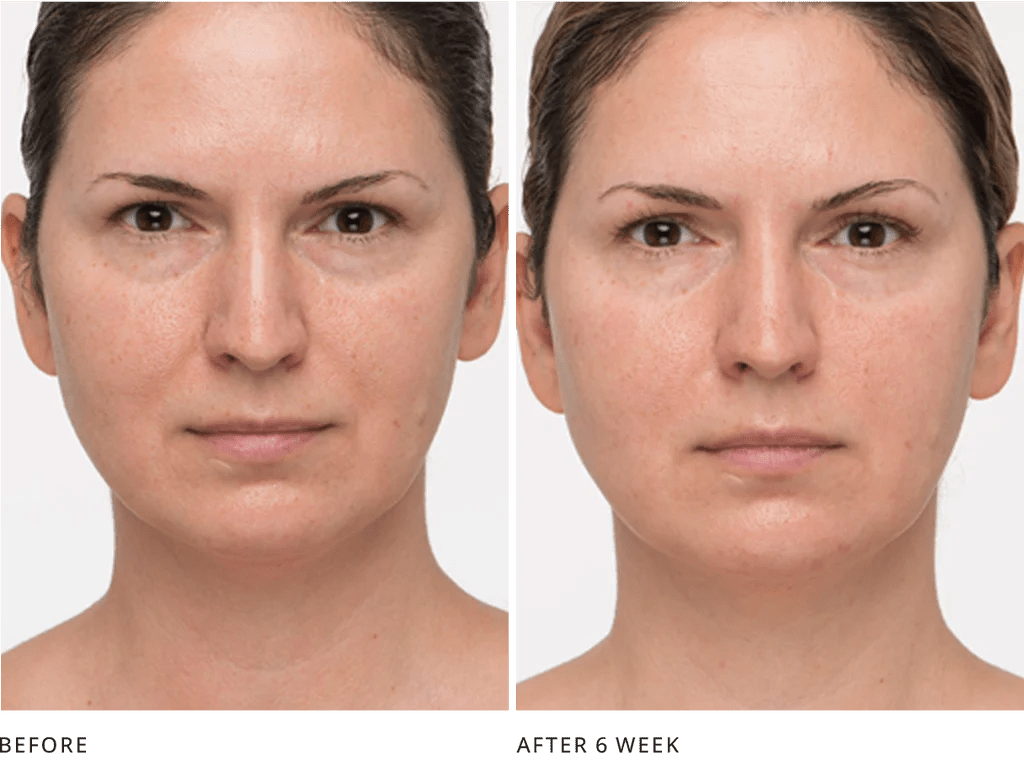 Your Eyes Look Refreshed, Less Hooded