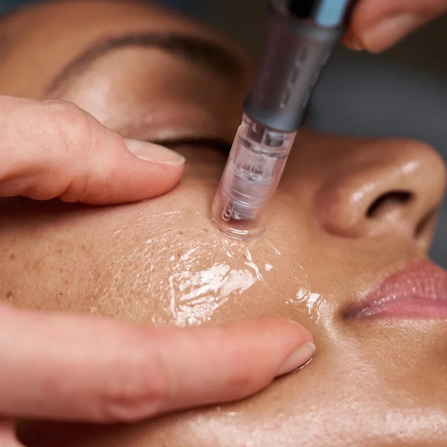 Exosome Facelift Facial in NYC: The Advanced Skin Renewal Treatment at Joanna Vargas