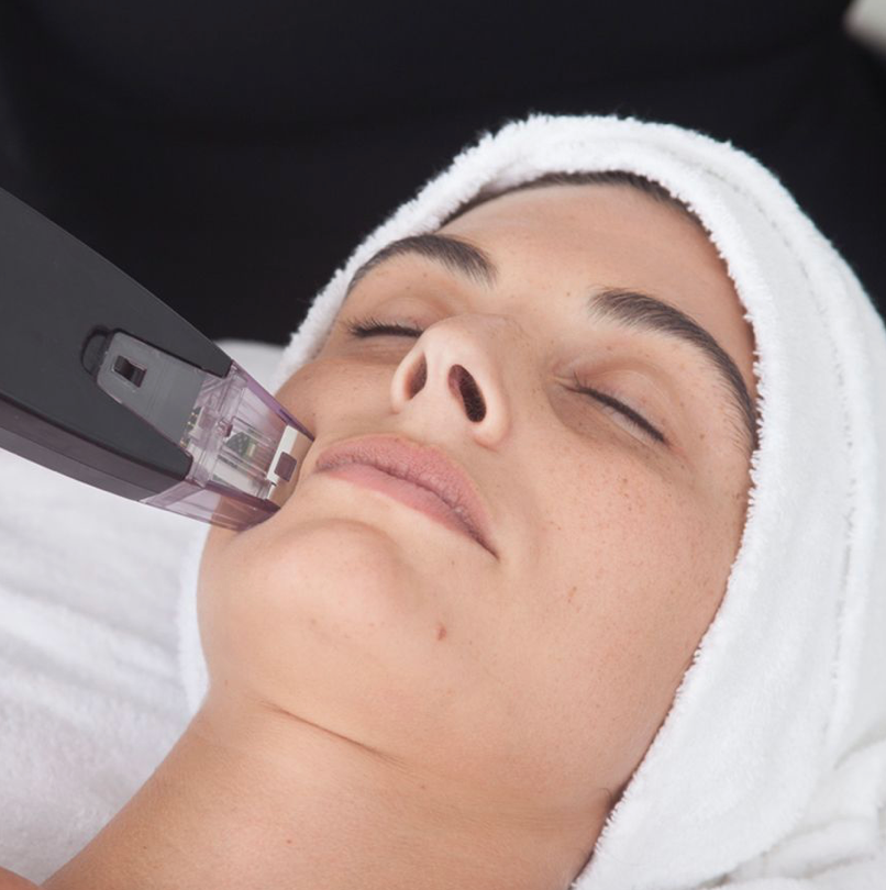 Twilight, our Microneedling RF Facial